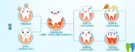 患有牙周病的人平時(shí)應(yīng)注意些什么？