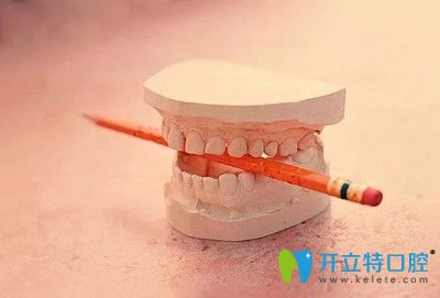 牙周炎 牙周炎