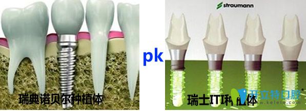 瑞典N(xiāo)obel(諾貝爾)種植體和瑞士ITI種植體