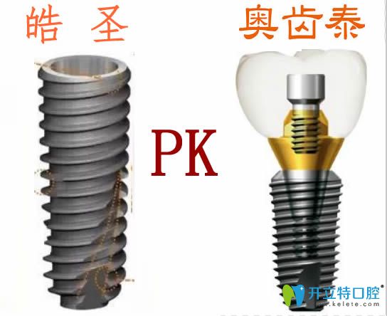 美國(guó)皓圣和韓國(guó)奧齒泰哪個(gè)種植體好？?jī)r(jià)格及使用壽命大PK