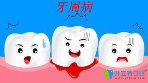 牙周病是什么？治療牙周病的方法和臨床效果分析