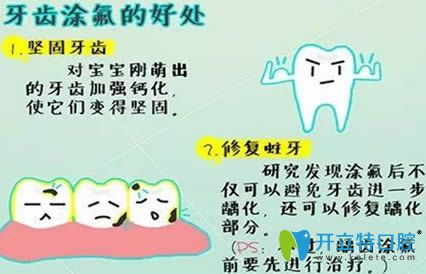開立特口腔網(wǎng)牙齒涂氟的好處