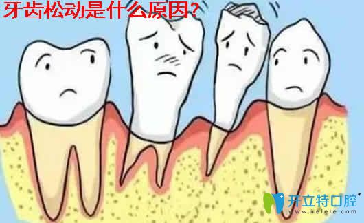 牙齒松動的原因