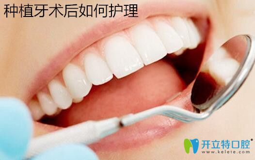 種植牙術(shù)后護(hù)理很重要,了解這些知識(shí)會(huì)讓種植牙壽命更長