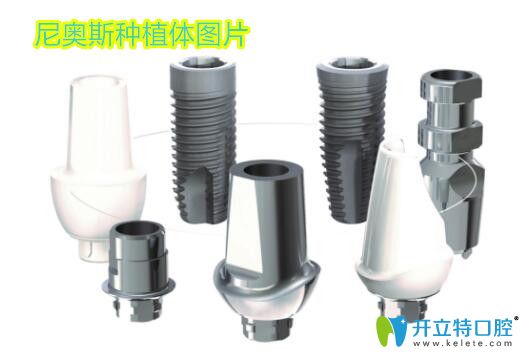 問(wèn)瑞典英國(guó)尼奧斯/neoss種植體怎么樣?多少錢的人,先搞清這個(gè)