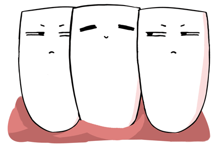 牙齒松動(dòng)動(dòng)畫圖解