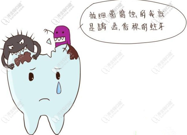 被細(xì)菌輔食就是齲齒俗稱(chēng)蛀牙