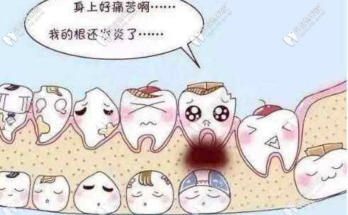 兒童齲齒的常見(jiàn)癥狀以及齲齒是如何產(chǎn)生