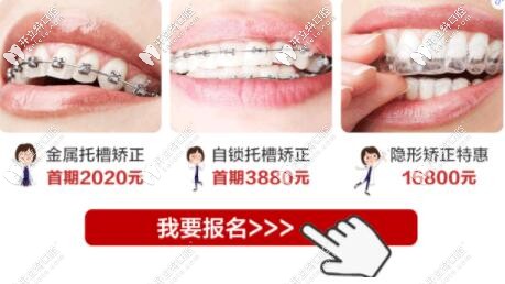 惠州致美口腔學(xué)生牙齒矯正優(yōu)惠 惠州致美口腔學(xué)生牙齒矯正優(yōu)惠