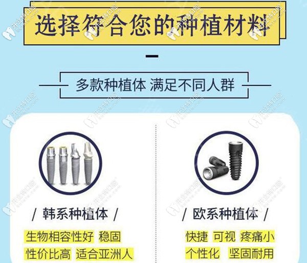 ?？诙c(diǎn)口腔韓系和歐系種植體