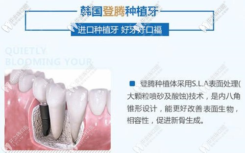 福州維樂口腔韓國登騰種植牙