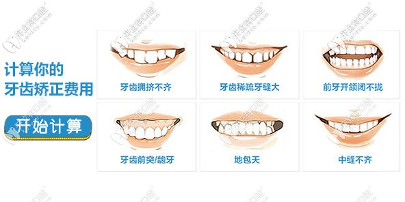 每個人牙齒矯正價格都是不一樣的
