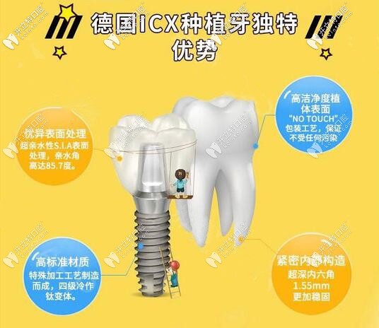 蘇州美奧德國ICX種植牙價(jià)格
