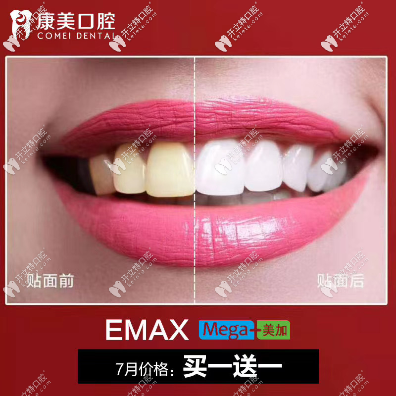 樹(shù)脂貼面買(mǎi)一贈(zèng)一