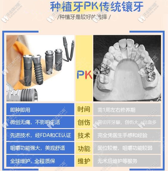 種植牙和傳統(tǒng)假牙哪個好