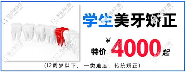 在淮安牙知道做mrc兒童矯治器價(jià)格低到4000起-活動沒幾天了