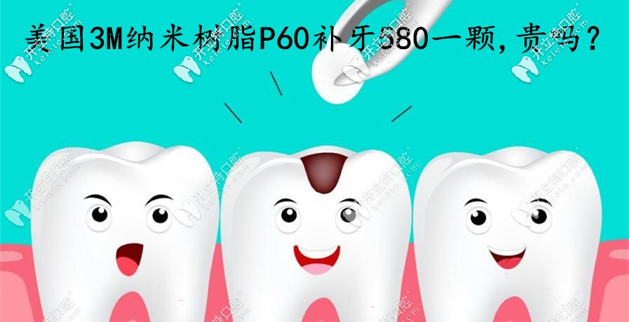 在煙臺做美國3MP60納米樹脂補牙580一顆，這費用算貴嗎