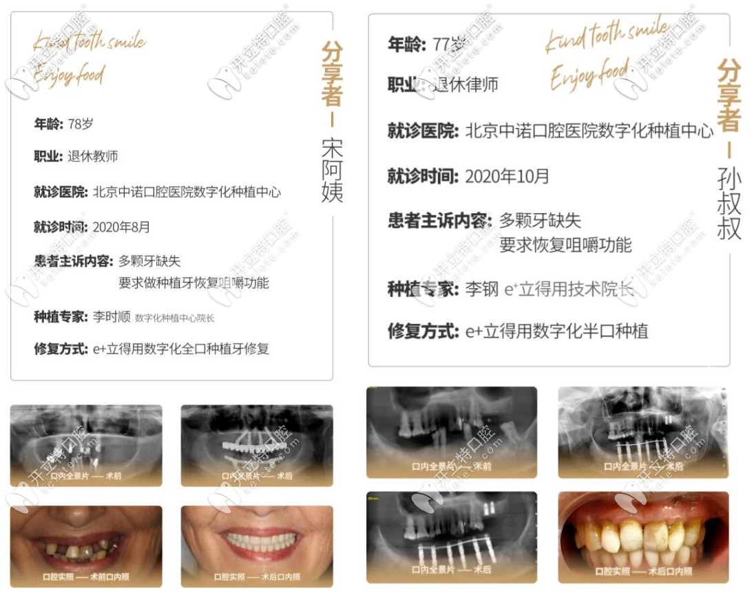 在中諾做半口種植牙和全口種植牙的老人的真實(shí)<span style=