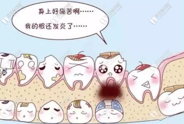 為什么有的人根管治療后牙齒反而更疼