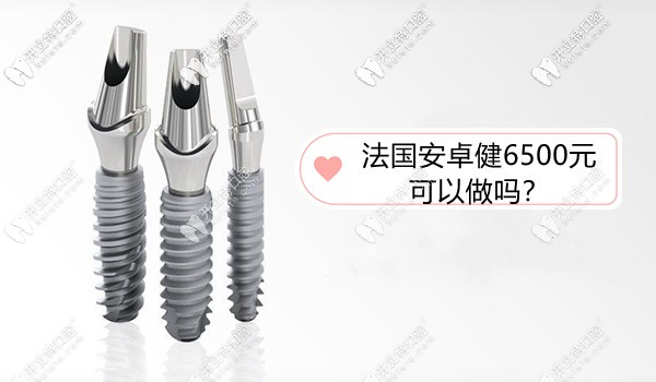 法國(guó)安卓健種植牙價(jià)格6500元可以做嗎?屬中端檔次性?xún)r(jià)比高