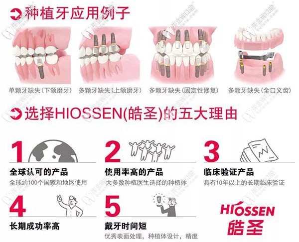 皓圣ETIII SA種植體，支持延期種植又擅于即刻種植