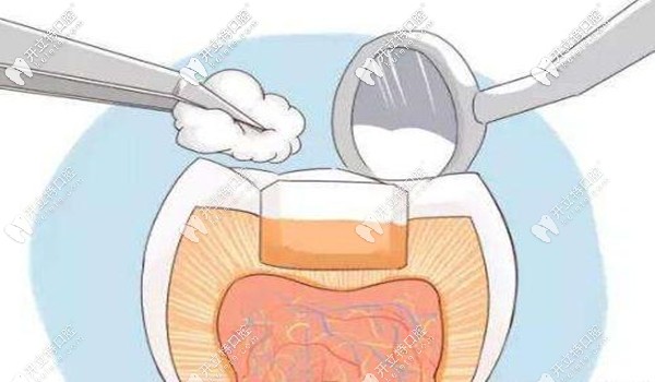 錦州拔牙、洗牙、全瓷牙等牙科項目的價格