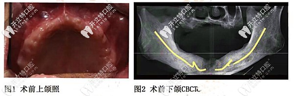 長春461醫(yī)院牙科收費價目表:種牙3980元/拔牙30元,電話預(yù)約快