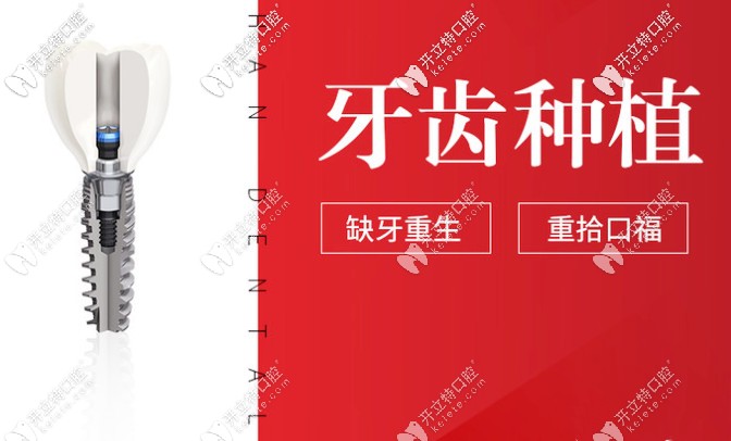 貴陽德韓口腔種植牙怎么樣？種牙技術(shù)好的醫(yī)生介紹奉上