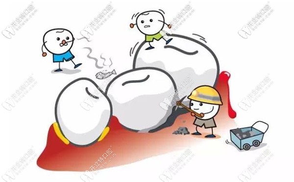 廣州德倫口腔收費標準及地址亮相，看牙弄清價格不迷路哦~