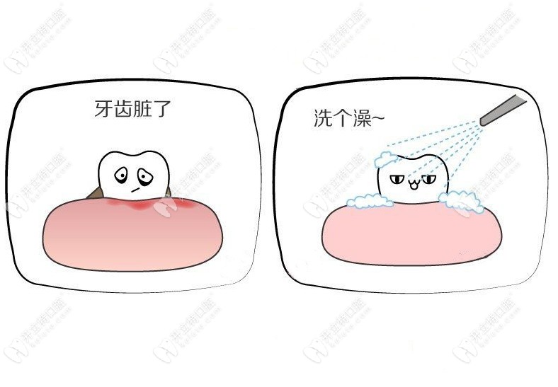 一起去佛山曙光金子做只要3600元起的韓國(guó)登騰進(jìn)口種植牙吧